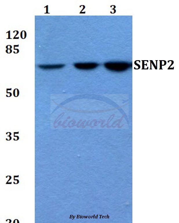 Western blot (WB) analysis of SENP2 (L512) pAb at 1:500 dilution Lane1:HEK293T whole cell lysate Lane2:A549 whole cell lysate Lane3:PC12 whole cell lysate