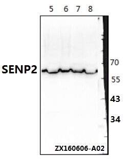 Western blot (WB) analysis of SENP2 (L512) pAb at 1:500 dillution Lane1:HEK293T whole cell lysate Lane2:PC3 whole cell lysate Lane3:The Testis tissue lysate of Mouse Lane4:The Testis tissue lysate of Rat