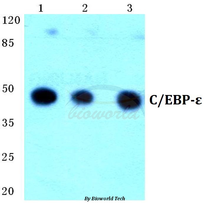 Western blot (WB) analysis of C/EBP-ε (K70) pAb at 1:500 dilution Lane1:HEK293T cell lysate Lane2:sp2/0 cell lysate Lane3:PC12 cell lysate treated with UV