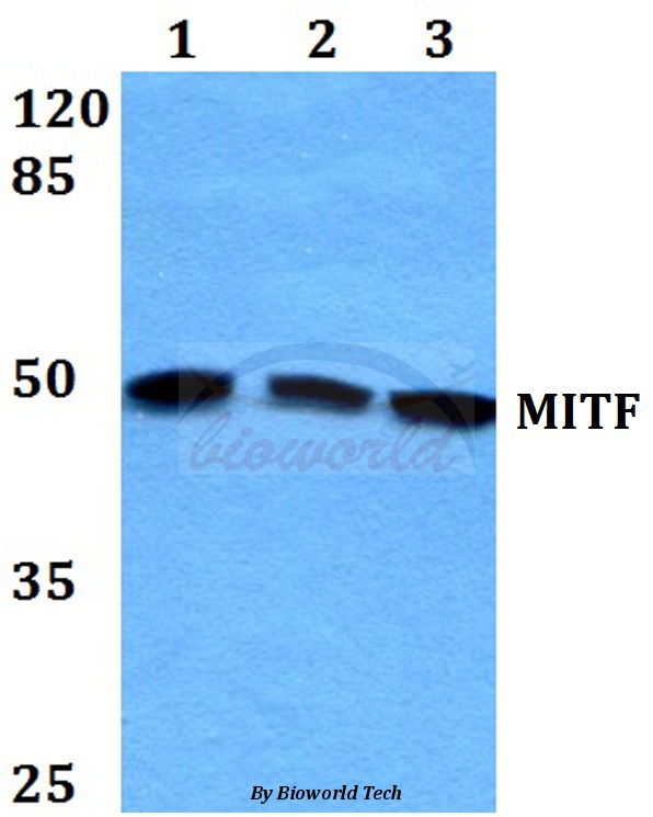 Western blot (WB) analysis of MITF (G174) pAb at 1:500 dilution Lane1:HEK293T whole cell lysate Lane2:sp2/0 whole cell lysate Lane3:PC12 whole cell lysate