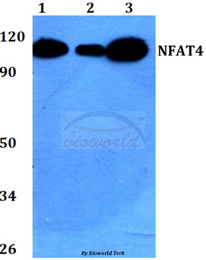 Western blot (WB) analysis of NFAT4 (E159) pAb at 1:500 dilution Lane1:HEK293T whole cell lysate Lane2:Raw264.7 whole cell lysate Lane3:H9C2 whole cell lysate