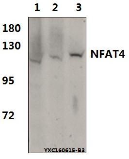 Western blot (WB) analysis of NFAT4 (E159) pAb at 1:500 dillution Lane1:PC3 whole cell lysate(60μg) Lane2:The Testis tissue lysate of Mouse(60μg) Lane3:The Testis tissue lysate of Rat(60μg)