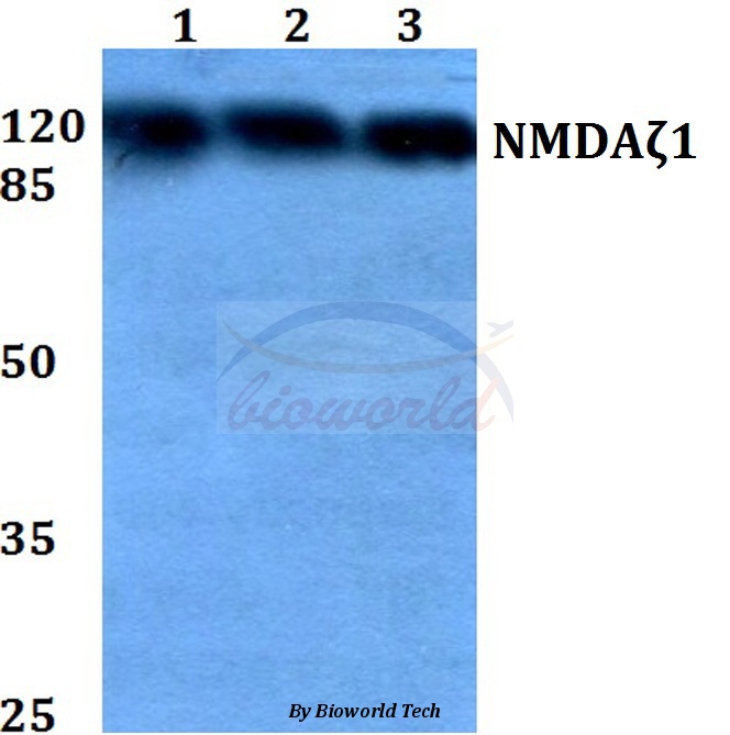 Western blot (WB) analysis of NMDAζ1 (S885) pAb at 1:500 dilution Lane1:HEK293T whole cell lysate Lane2:Raw264.7 whole cell lysate Lane3:H9C2 whole cell lysate