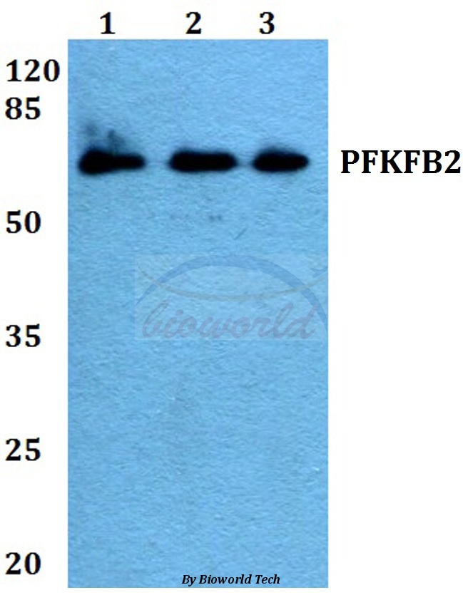 Western blot (WB) analysis of PFKFB2 (P479) pAb at 1:500 dilution Lane1:A549 whole cell lysate Lane2:Raw264.7 whole cell lysate Lane3:H9C2 whole cell lysate