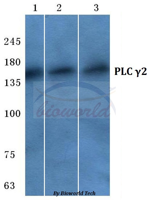 Western blot (WB) analysis of PLC γ2 (N1211) pAb at 1:500 dilution Lane1:Hela cell lysate Lane2:sp2/0 cell lysate Lane3:Rat lung tissue lysate