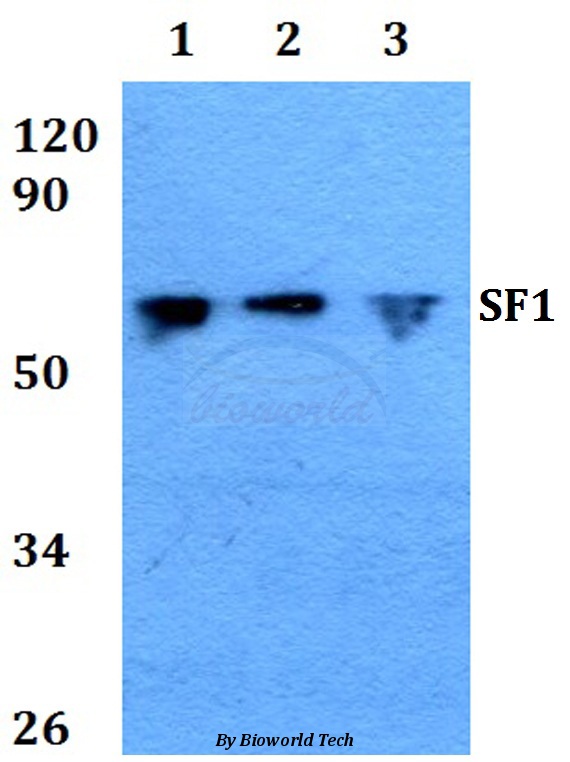 Western blot (WB) analysis of SF1 (P76) pAb at 1:500 dilution Lane1:HEK293T whole cell lysate treated with TNFa(20ng/ml,15mins) Lane2:NIH-3T3 whole cell lysate Lane3:Rat brain tissue lysate