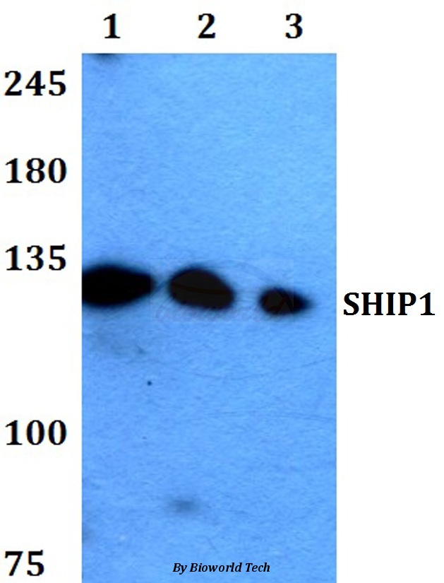 Western blot (WB) analysis of SHIP1 (M1014) pAb at 1:500 dilution Lane1:HEK293T whole cell lysate Lane2:sp2/0 whole cell lysate Lane3:PC12 whole cell lysate