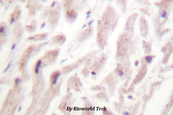 Immunohistochemistry (IHC) analyzes of Dematin (E397) pAb in paraffin-embedded human hearttissue.