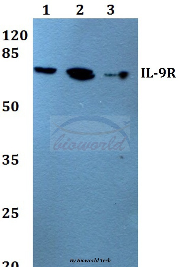 Western blot (WB) analysis of IL-9R (L514) pAb at 1:500 dilution Lane1:HEK293T whole cell lysate Lane2:A549 whole cell lysate Lane3:H9C2 whole cell lysate