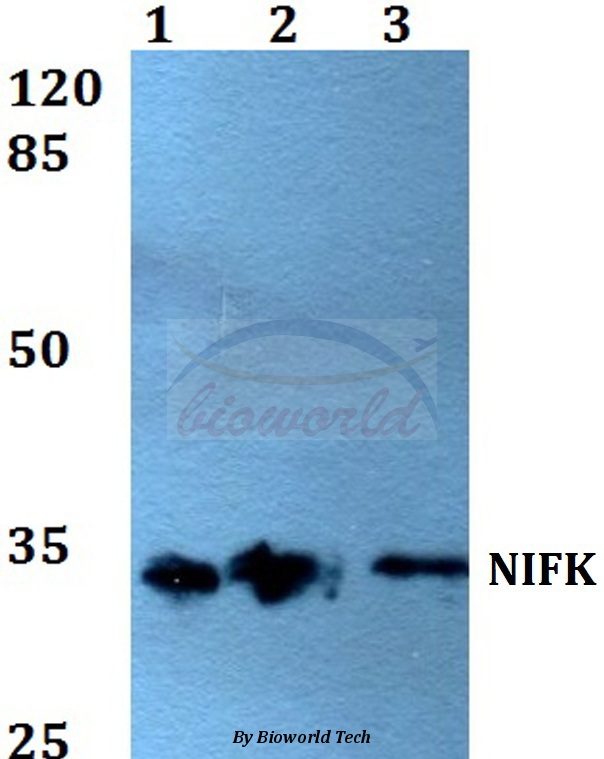 Western blot (WB) analysis of NIFK (D229) pAb at 1:500 dilution Lane1:A549 whole cell lysate Lane2:Raw264.7 whole cell lysate Lane3:H9C2 whole cell lysate