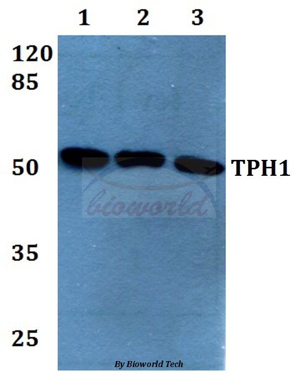 Western blot (WB) analysis of TPH1 (K54) pAb at 1:500 dilution Lane1:HEK293T whole cell lysate Lane2:sp2/0 whole cell lysate Lane3:H9C2 whole cell lysate