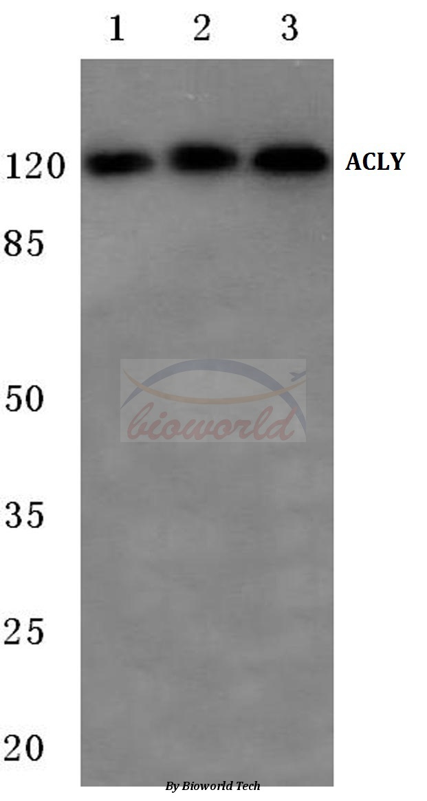 Western blot (WB) analysis of ATP-citrate synthase (P449) pAb at 1:500 dilution Lane1:MCF-7 cell lysate Lane2:Raw264.7 cell lysate Lane3:Rat liver tissue lysate