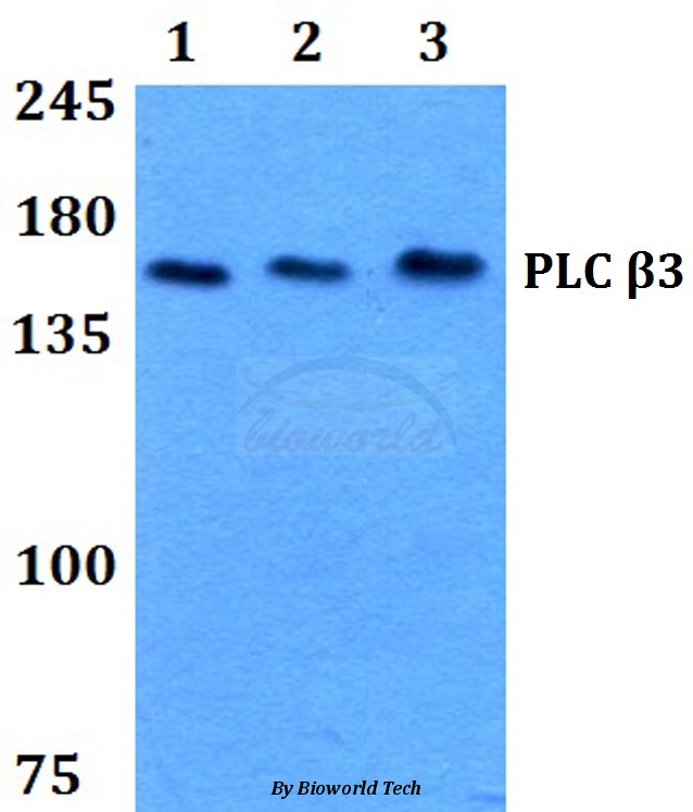 Western blot (WB) analysis of PLC β3 (L532) pAb at 1:500 dilution Lane1:HEK293T whole cell lysate Lane2:sp2/0 whole cell lysate Lane3:H9C2 whole cell lysate