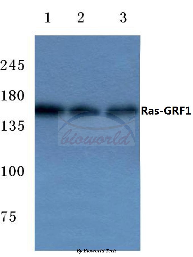 Western blot (WB) analysis of Ras-GRF1 (F912) pAb at 1:500 dilution Lane1:Hela cell lysate Lane2:Mouse kidney tissue lysate Lane3:Rat brain tissue lysate