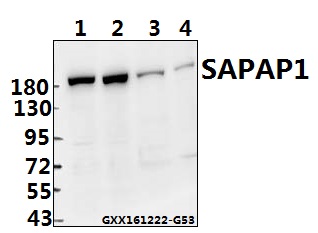 Western blot (WB) analysis of SAPAP1 (E817) pAb at 1:500 dilution Lane1:The Brain tissue lysate of Mouse(40ug) Lane2:The Brain tissue lysate of Rat(40ug) Lane3:U-87MG whole cell lysate(40ug) Lane4:U-251MG whole cell lysate(40ug)