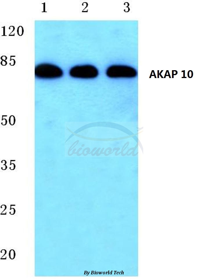 Western blot (WB) analysis of AKAP 10 (R27) pAb at 1:500 dilution Lane1:Hepg2 cell lysate Lane2:Mouse heart tissue lysate Lane3:Rat heart tissue lysate