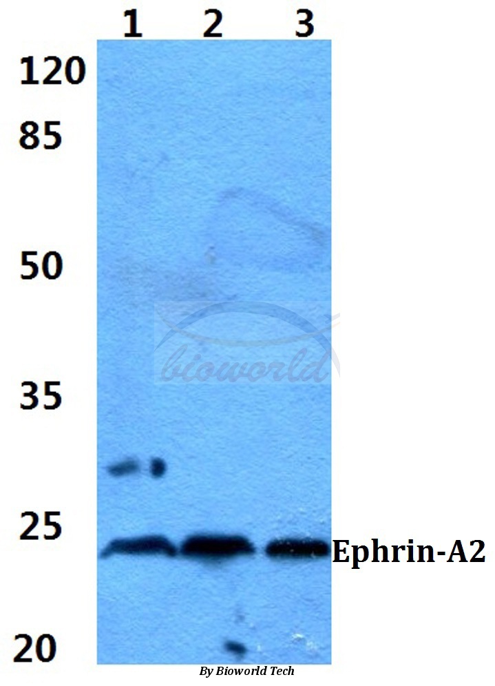Western blot (WB) analysis of Ephrin-A2 (N33) pAb at 1:500 dilution Lane1:MCF-7 cell lysate Lane2:Rat spleen tissue lysate Lane3:Mouse spleen tissue lysate