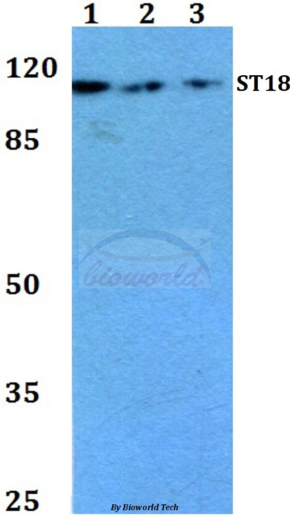 Western blot (WB) analysis of ST18 (E72) pAb at 1:500 dilution Lane1:HEK293T whole cell lysate Lane2:Raw264.7 whole cell lysate Lane3:H9C2 whole cell lysate