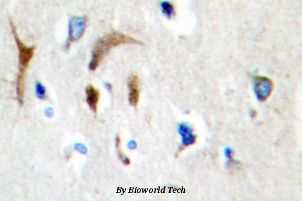 Immunohistochemistry (IHC) analyzes of HBP1 (L468) pAb in paraffin-embedded human brain tissue.