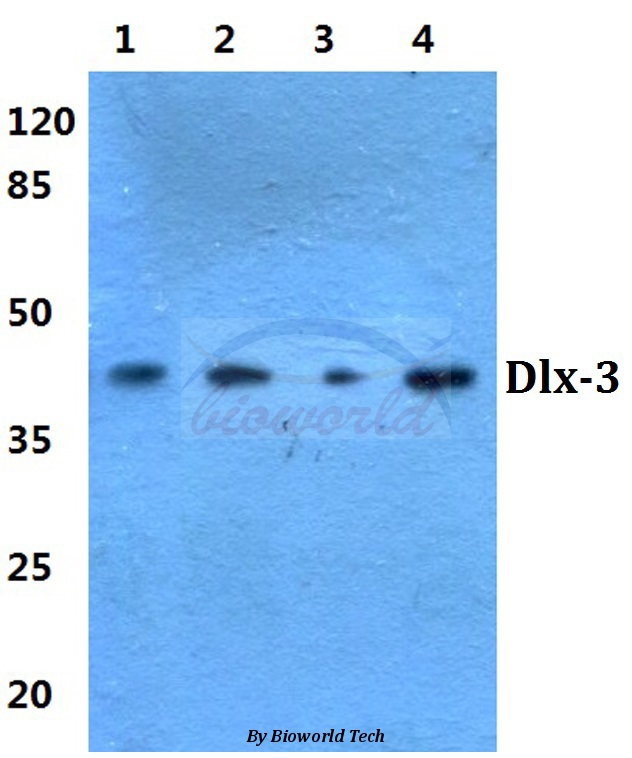 Western blot (WB) analysis of Dlx-3 (D107) pAb at 1:500 dilution Lane1:Hela cell lysate Lane2:HEK293T cell lysate Lane3:sp2/0 cell lysate Lane4:PC12 cell lysate