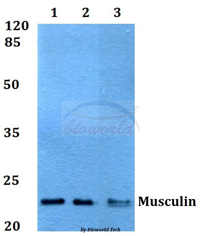 Western blot (WB) analysis of Musculin (R167) pAb at 1:500 dilution Lane1:HepG2 whole cell lysate Lane2:Raw264.7 whole cell lysate Lane3:PC12 whole cell lysate