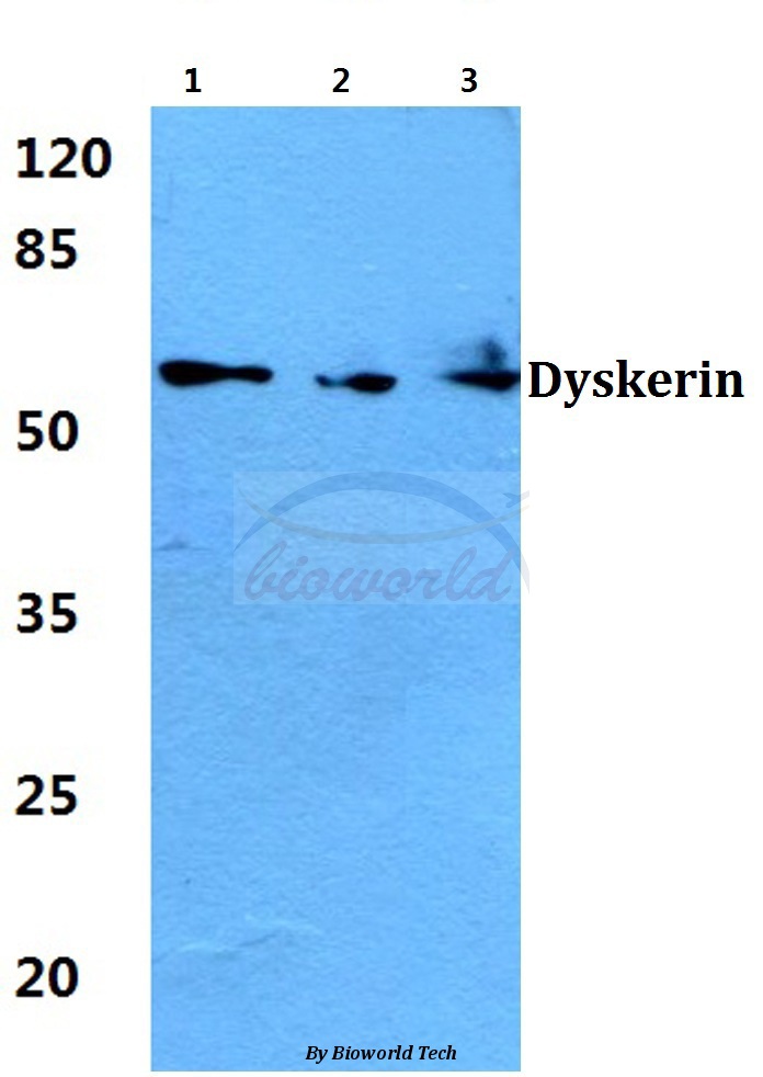 Western blot (WB) analysis of Dyskerin (K203) pAb at 1:500 dilution Lane1:A549 cell lysate Lane2:Mouse brain tissue lysate Lane3:Rat brain tissue lysate