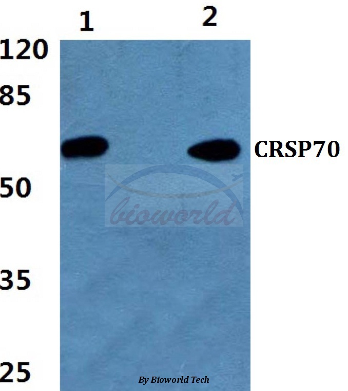 Western blot (WB) analysis of CRSP70 (S7) pAb at 1:500 dilution Lane1:A549 cell lysate Lane2:PC12 cell lysate