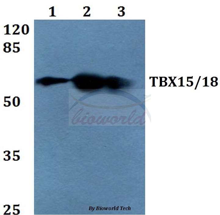 Western blot (WB) analysis of TBX15/18 (D164) pAb at 1:500 dilution Lane1:HEK293T whole cell lysate Lane2:Raw264.7 whole cell lysate Lane3:PC12 whole cell lysate
