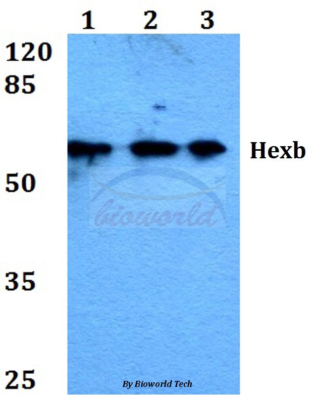 Western blot (WB) analysis of Hexb (S516) pAb at 1:500 dilution Lane1:Jurkat whole cell lysate Lane2:Raw264.7 whole cell lysate Lane3:H9C2 whole cell lysate