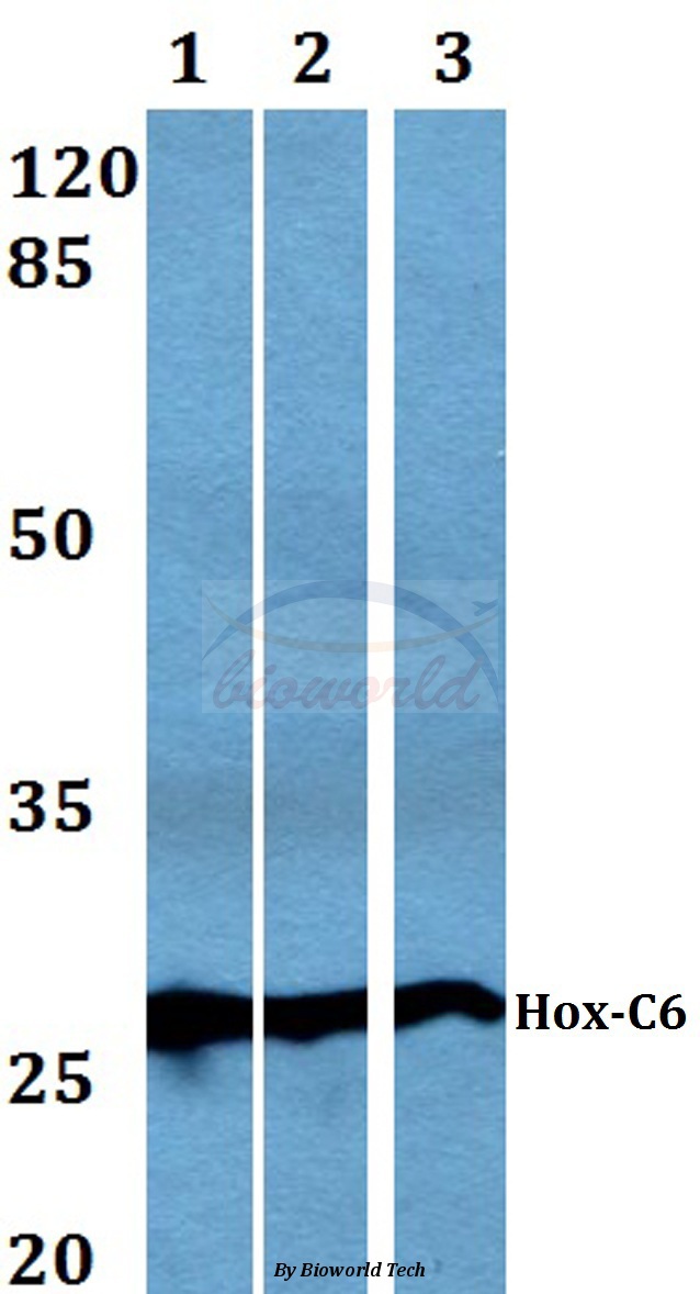 Western blot (WB) analysis of Hox-C6 (G220) pAb at 1:500 dilution Lane1:MCF-7 whole cell lysate Lane2:Raw264.7 whole cell lysate Lane3:PC12 whole cell lysate