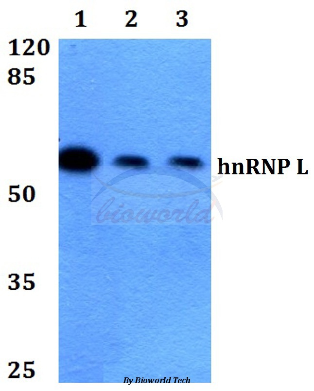 Western blot (WB) analysis of hnRNP L (G58) pAb at 1:500 dilution Lane1:HEK293T whole cell lysate Lane2:Raw264.7 whole cell lysate Lane3:PC12 whole cell lysate