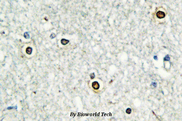 Immunohistochemistry (IHC) analyzes of ATF-7 (F74) pAb in paraffin-embedded human brain tissue.