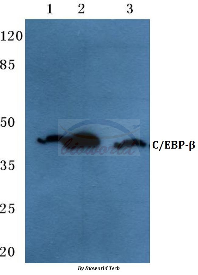 Western blot (WB) analysis of C/EBP-β (V259) pAb at 1:500 dilution Lane1:HEK293T cell lysate Lane2:NIH-3T3 cell lysate Lane3:H9C2 cell lysate
