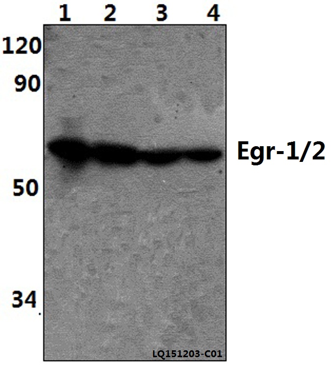 Western blot (WB) analysis of Egr-1/2 (R409) pAb at 1:500 dilution Lane1:HEK293T whole cell lysate(40ug) Lane2:PC12 whole cell lysate(40ug) Lane3:NIH-3T3 whole cell lysate(40ug) Lane3:Jurkat whole cell lysate(40ug)