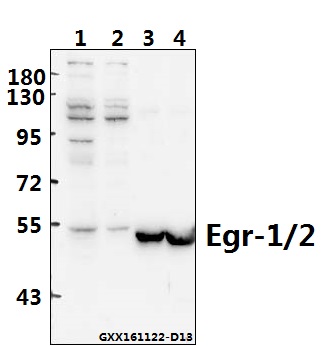 Western blot (WB) analysis of Egr-1/2 (R409) pAb at 1:500 dilution Lane1:HCT116 whole cell lysate(40ug) Lane2:MCF-7 whole cell lysate(40ug) Lane3:The Heart tissue lysate of Mouse(40ug) Lane4:The Heart tissue lysate of Rat(40ug)