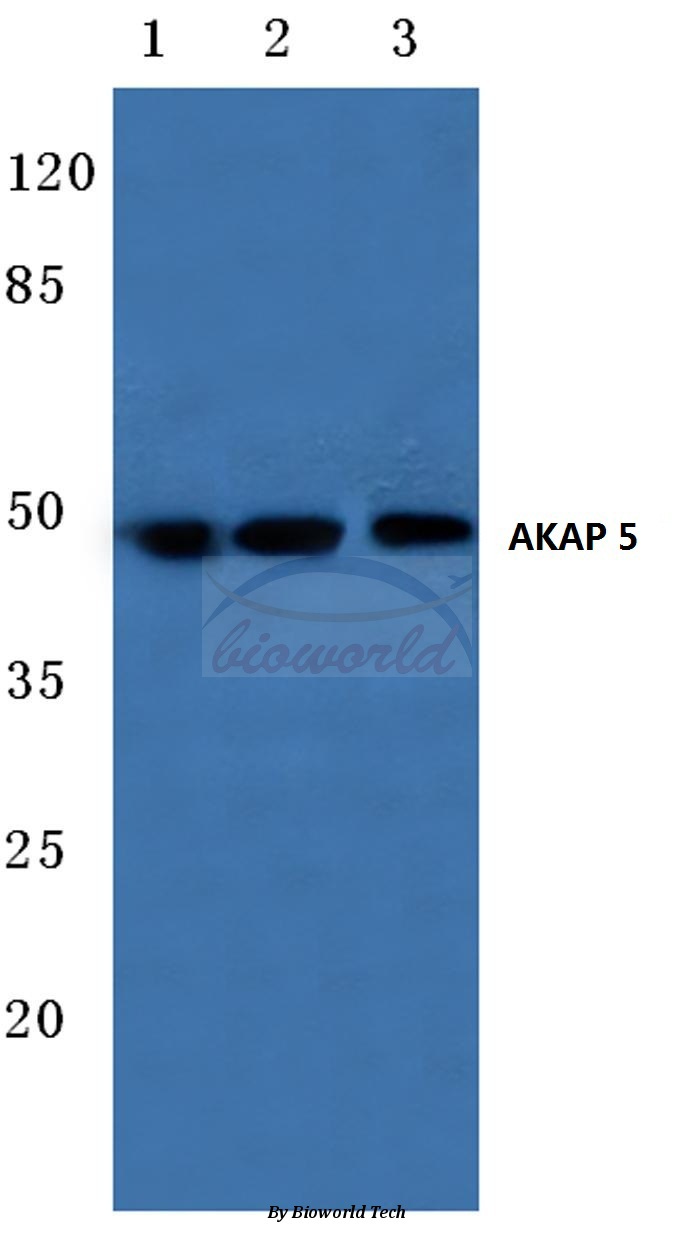 Western blot (WB) analysis of AKAP 5 (E7) pAb at 1:500 dilution Lane1:HEK293T cell lysate Lane2:NIH-3T3 cell lysate Lane3:H9C2 cell lysate