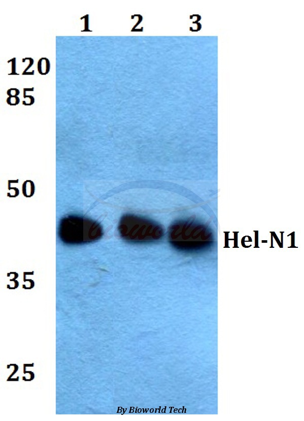 Western blot (WB) analysis of Hel-N1 (N86) pAb at 1:500 dilution Lane1:A549 whole cell lysate Lane2:NIH-3T3 whole cell lysate Lane3:Rat brain tissue lysate