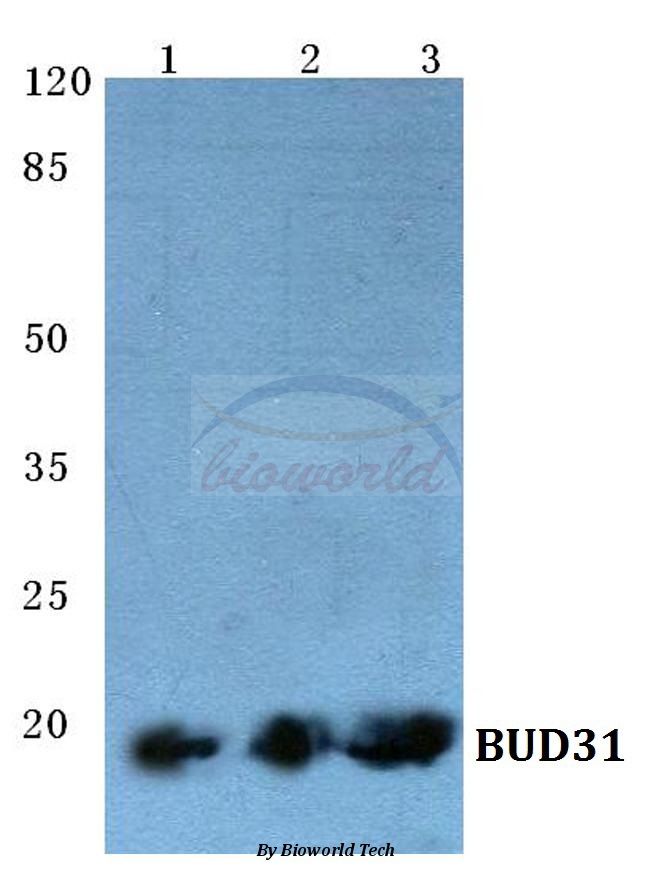 Western blot (WB) analysis of BUD31 (E24) pAb at 1:500 dilution Lane1:Hela cell lysate Lane2:Mouse liver tissue lysate Lane3:Rat liver tissue lysate