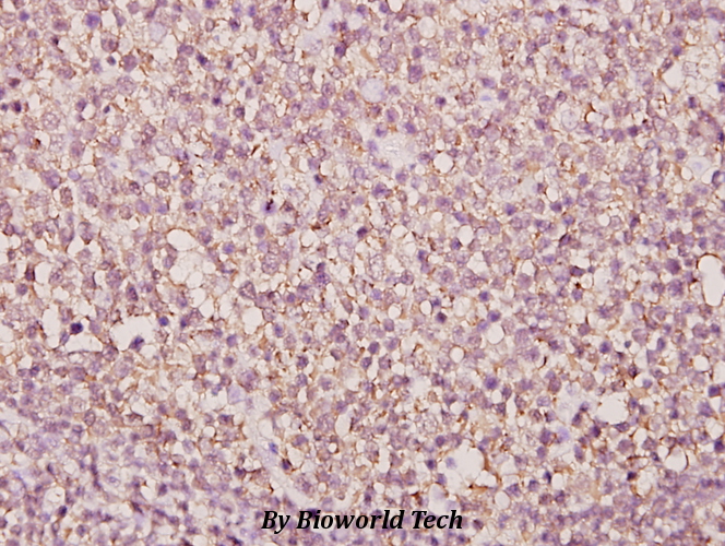 Immunohistochemistry (IHC) analyzes of BUD31 (E24) pAb in paraffin-embedded human tonsil carcinoma tissue at 1:50.