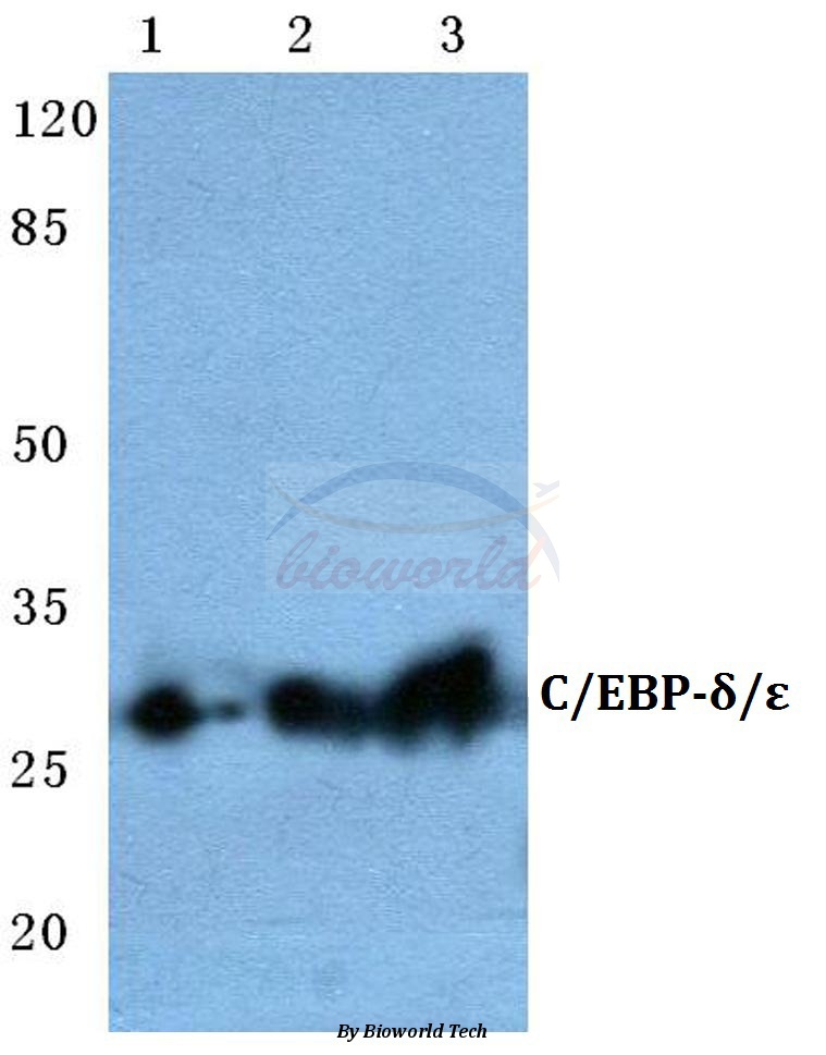 Western blot (WB) analysis of C/EBP-δ/ε (A217) pAb at 1:500 dilution Lane1:HEK293T cell lysate Lane2:Mouse liver tissue lysate Lane3:Rat liver tissue lysate