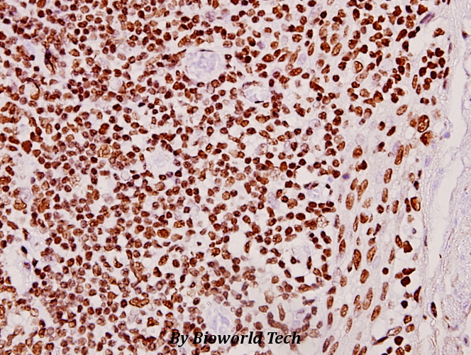 Immunohistochemistry (IHC) analyzes of CLK2 (R15) pAb in paraffin-embedded human tonsil carcinoma tissue at 1:50.