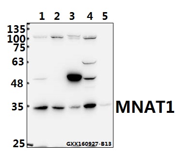 Western blot (WB) analysis of MNAT1 (E123) pAb at 1:500 dilution Lane1:DLD whole cell lysate(40ug) Lane2:HCT116 whole cell lysate(40ug) Lane3:The Testis tissue lysate of Mouse(40ug) Lane4:The Testis tissue lysate of Rat(40ug) Lane5:The Colon tissue lysate of Rat(40ug)