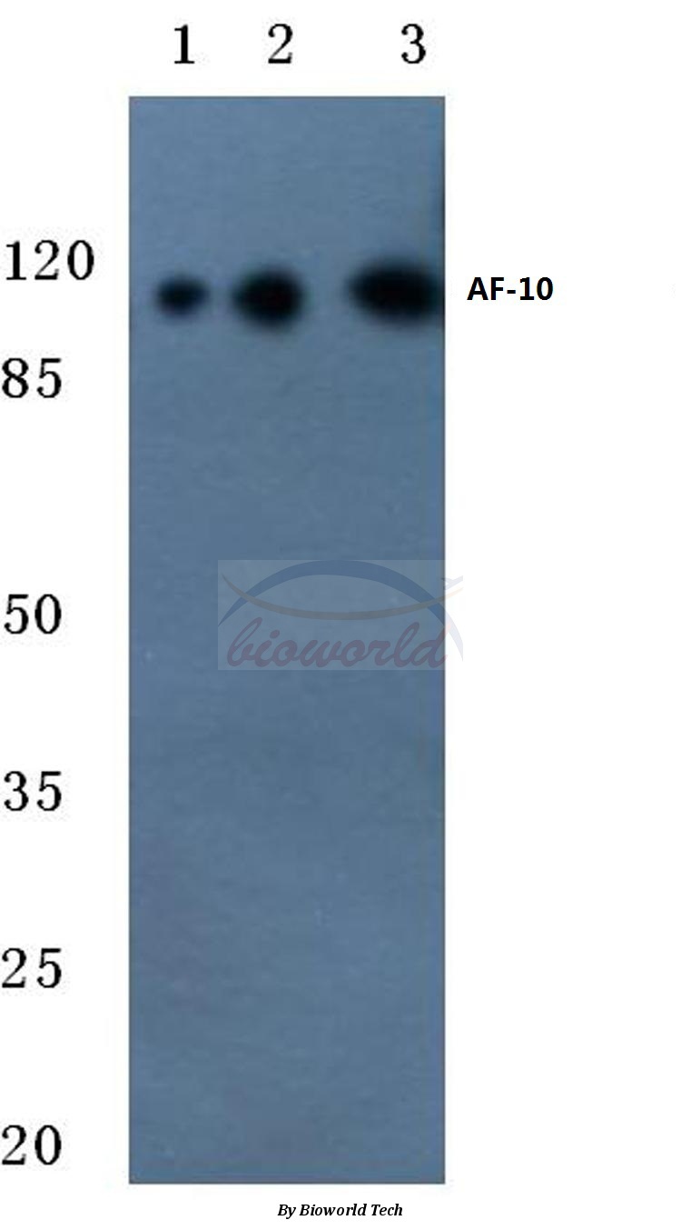 Western blot (WB) analysis of AF-10 (E237) pAb at 1:500 dilution Lane1:Hela cell lysate Lane2:Mouse testis tissue lysate Lane3:Rat testis tissue lysate