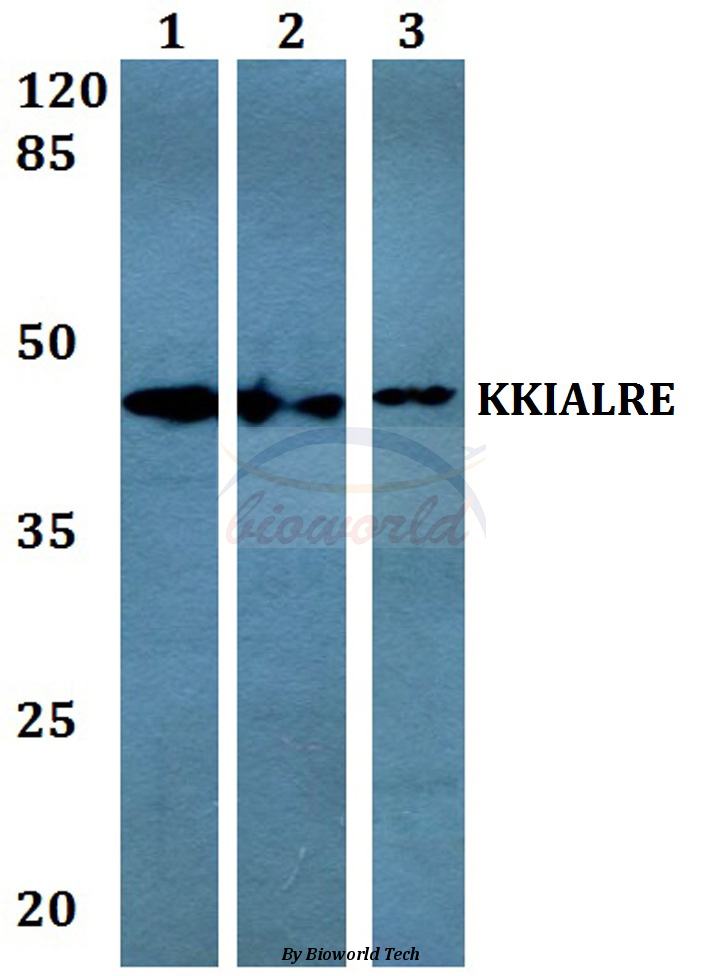 Western blot (WB) analysis of KKIALRE (N301) pAb at 1:500 dilution Lane1:MCF-7 whole cell lysate Lane2:Raw264.7 whole cell lysate Lane3:PC12 whole cell lysate