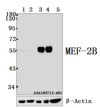Western blot (WB) analysis of MEF-2B (P98) pAb at 1:500 dilution Lane1:The Muscle tissue lysate of Rat(10ug) Lane2:The Muscle tissue lysate of Mouse(10ug) Lane3:The Brain tissue lysate of Rat(10ug) Lane4:The Brain tissue lysate of Mouse(10ug) Lane5:U-87MG