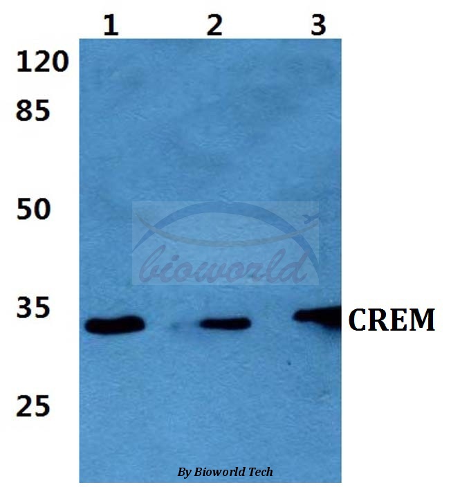 Western blot (WB) analysis of CREM (I106) pAb at 1:500 dilution Lane1:THP-1 cell lysate Lane2:Raw264.7 cell lysate Lane3:PC12 cell lysate