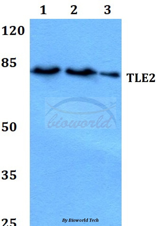Western blot (WB) analysis of TLE2 (K214) pAb at 1:500 dilution Lane1:MCF-7 whole cell lysate Lane2:Raw264.7 whole cell lysate Lane3:PC12 whole cell lysate