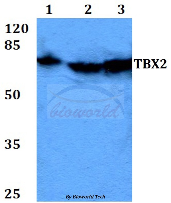Western blot (WB) analysis of TBX2 (N280)pAb at 1:500 dilution Lane1:HEK293T whole cell lysate Lane2:Raw264.7 whole cell lysate Lane3:PC12 whole cell lysate
