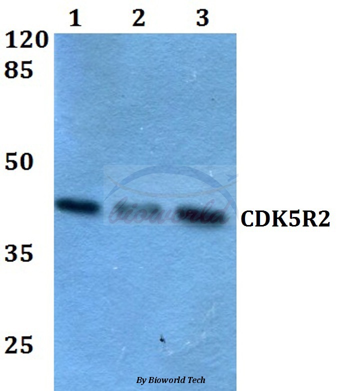Western blot (WB) analysis of CDK5R2 (N100) pAb at 1:500 dilution Lane1:HEK293T whole cell lysate Lane2:Raw264.7 whole cell lysate Lane3:H9C2 whole cell lysate