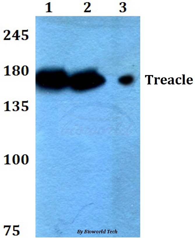 Western blot (WB) analysis of Treacle (Q55) pAb at 1:500 dilution Lane1:HEK293T whole cell lysate Lane2:Raw264.7 whole cell lysate Lane3:H9C2 whole cell lysate